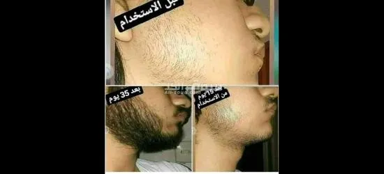 مجموعة منتج تكثيف اللحية الوفيرا جل ،الاقوى فعالية والاشهر