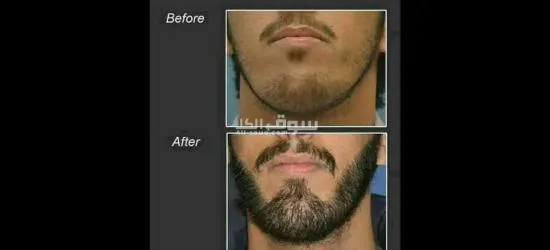 مجموعة منتج تكثيف اللحية الوفيرا جل ،الاقوى فعالية والاشهر - 2