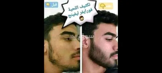 مجموعة منتج تكثيف اللحية الوفيرا جل ،الاقوى فعالية والاشهر - 4